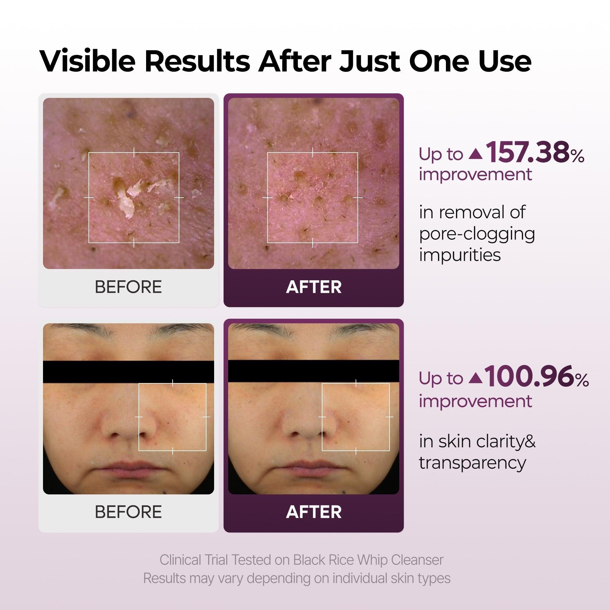 Peel Shot Black Rice Mochi Whip Cleanser