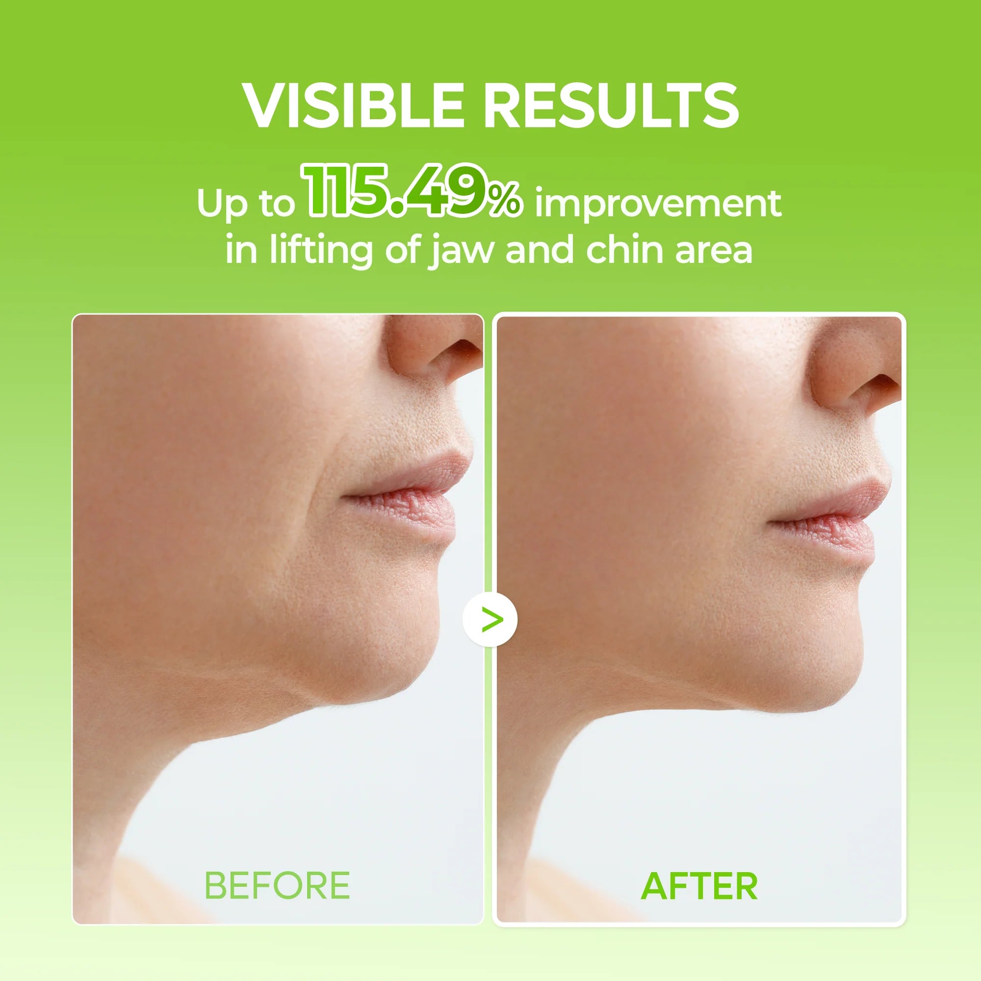 CACTOX V-Lifting Mewing Band 4EA